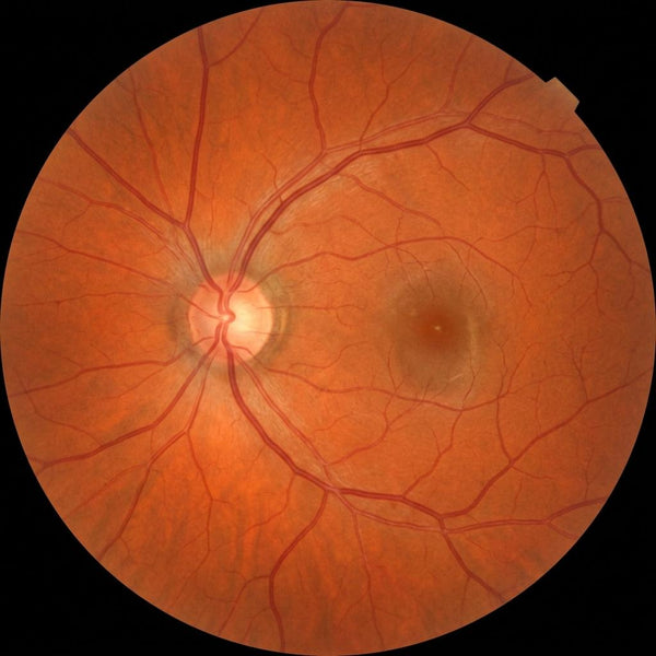 The Science of Optic Nerve Health